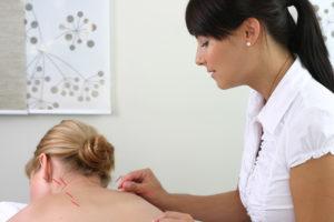 acupuncture 300x200